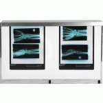 NÉGATOSCOPE STANDARD 2 PLAGES 72 X 43 CM 108 W - MANUTAN COLLECTIVITÉS